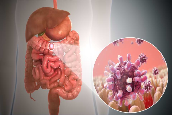 Gastrointestinal & Hepato Biliary Cancers